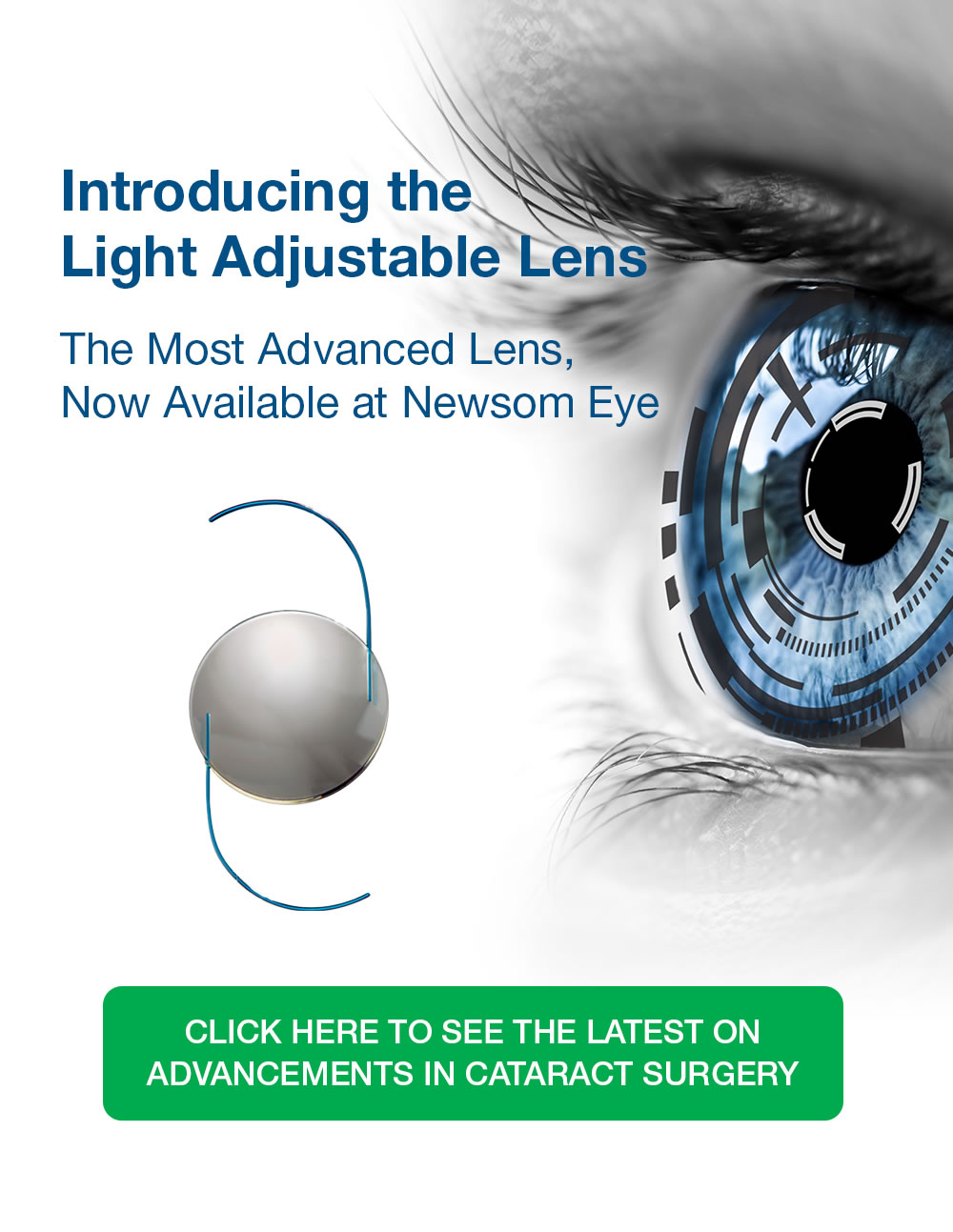 Light Adjustable Lens for Cataract Surgery Patients