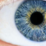 Newsom Eye Cataract Surgery
