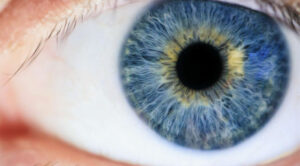 Newsom Eye Cataract Surgery