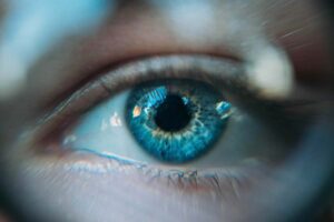 Common Eye Conditions & How to Treat Them