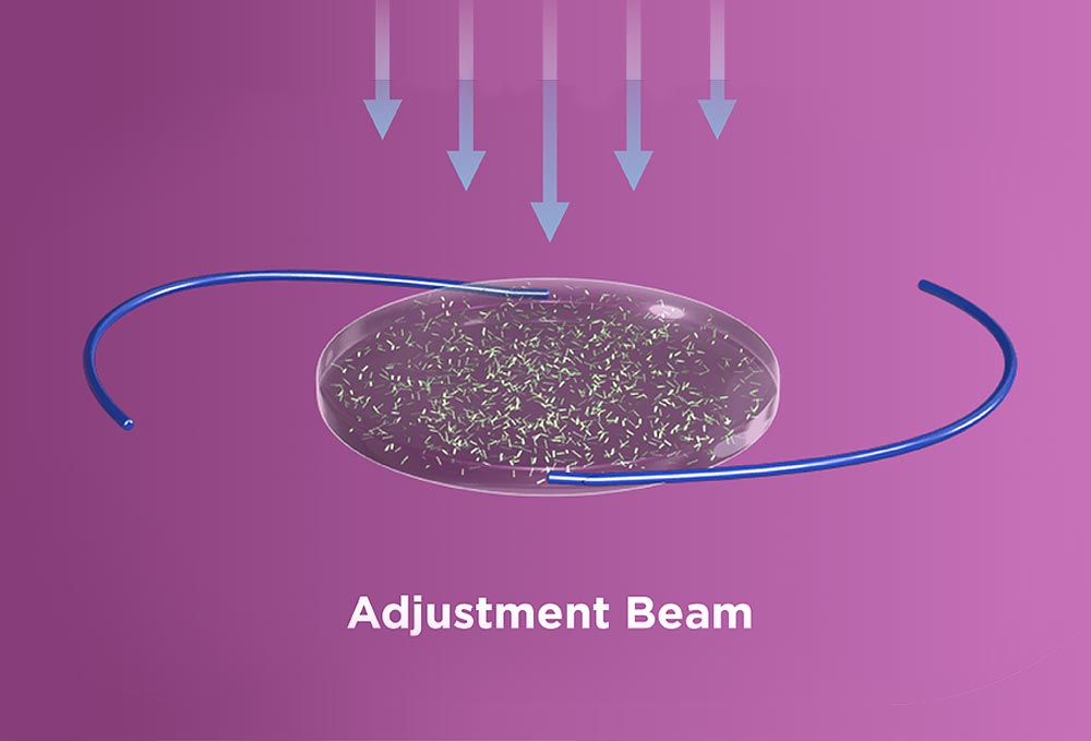 Light Adjustable Lens being adjusted with UV light